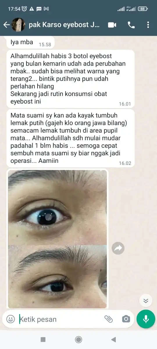 testi-katarak-1