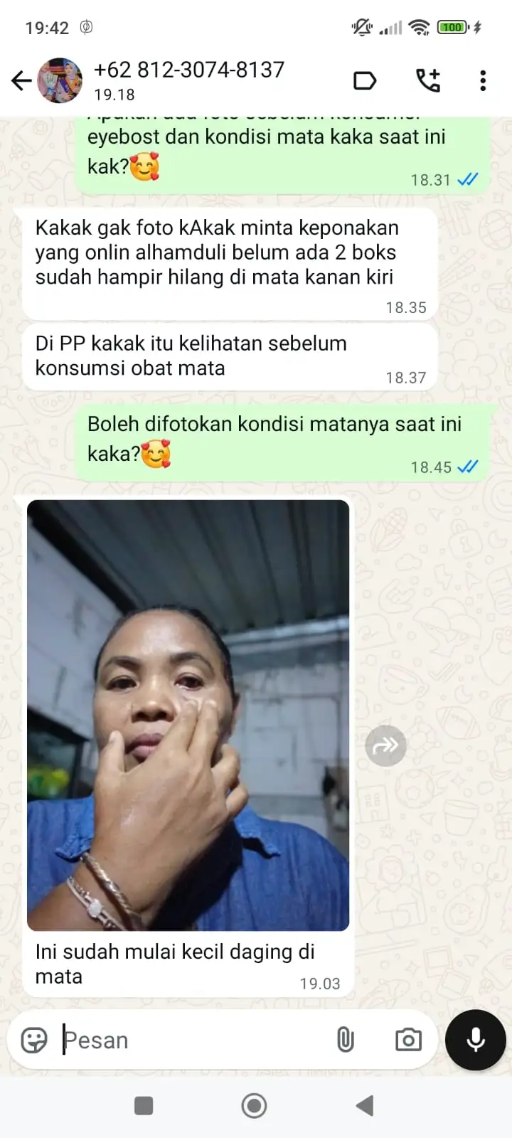 LEMAK-MATA.webp